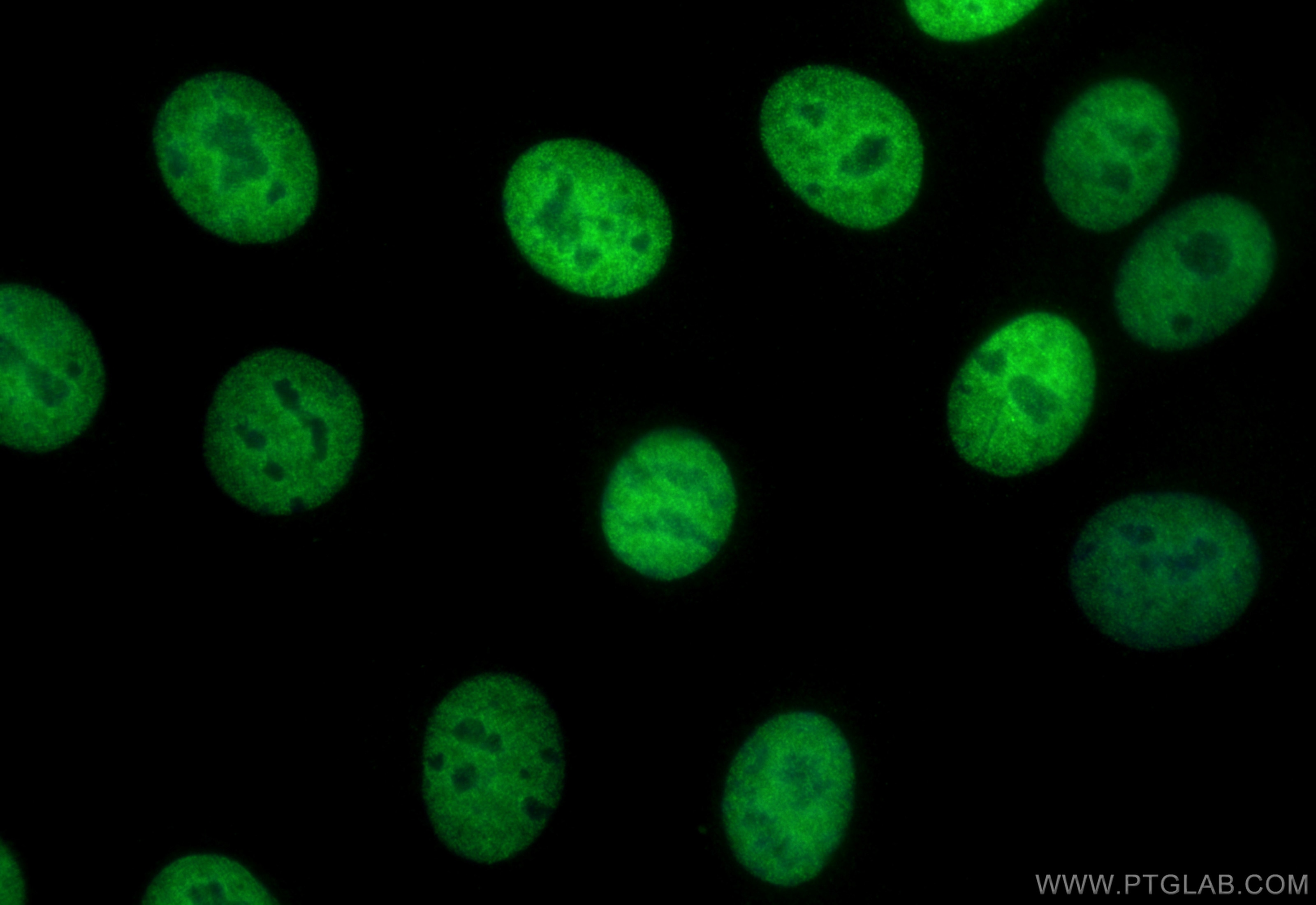 Immunofluorescence (IF) / fluorescent staining of MCF-7 cells using CoraLite® Plus 488-conjugated TRPS1 Polyclonal ant (CL488-21938)