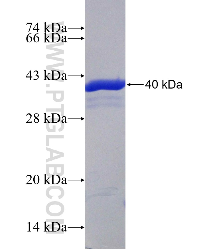 TRPS1 fusion protein Ag30188 SDS-PAGE