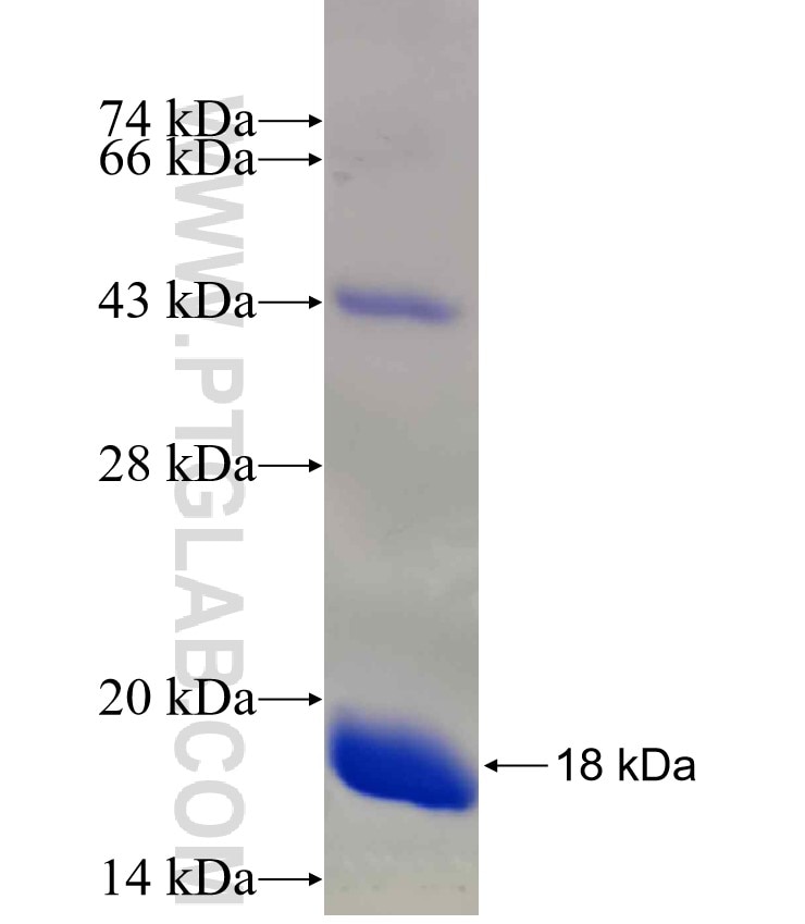 TRPS1 fusion protein Ag30199 SDS-PAGE