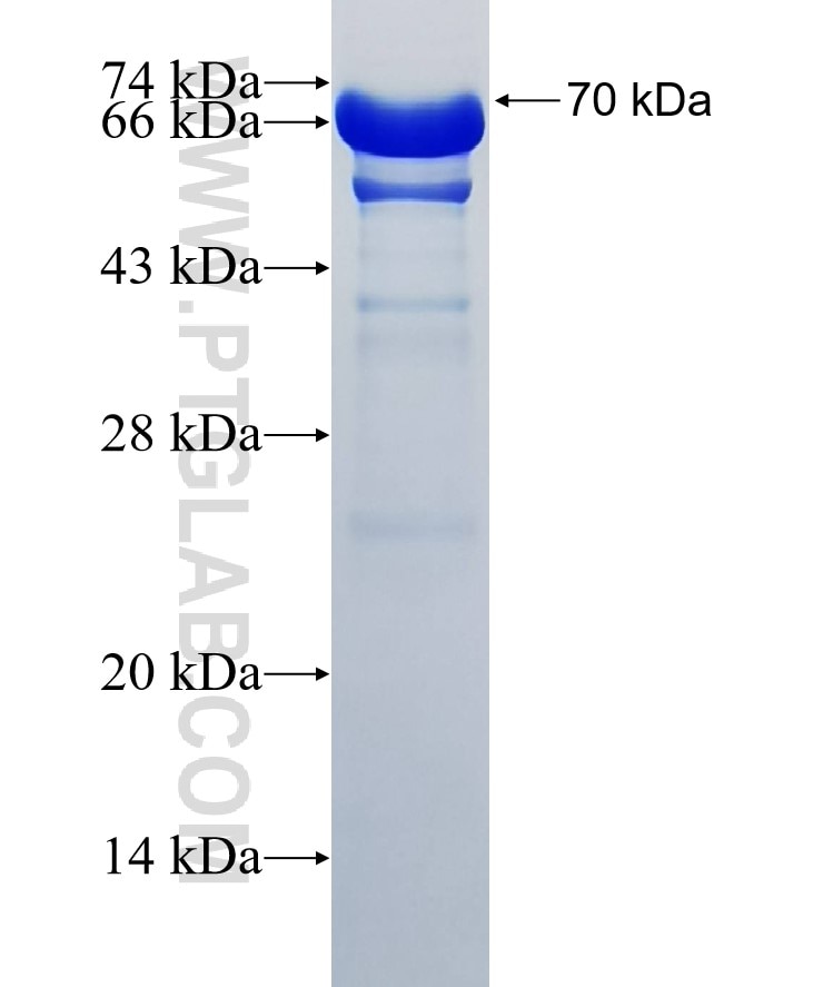 TRPS1 fusion protein Ag33959 SDS-PAGE