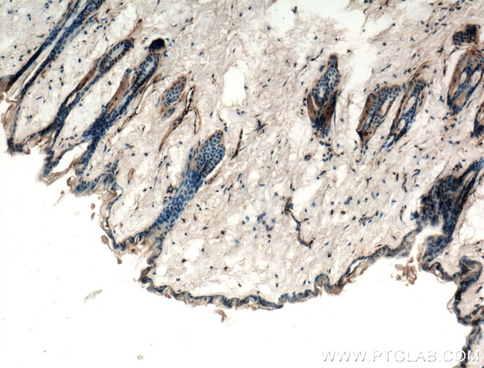 IHC staining of mouse skin using 22686-1-AP