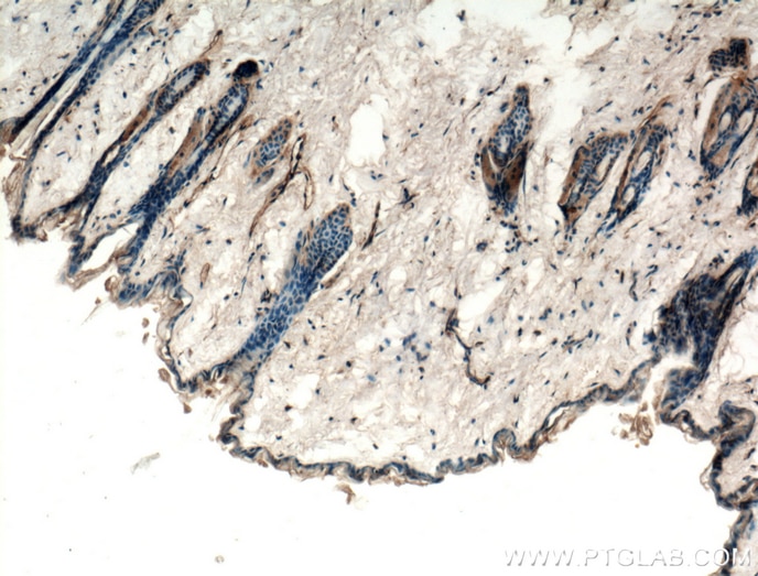 Immunohistochemistry (IHC) staining of mouse skin tissue using TRPV1 Polyclonal antibody (22686-1-AP)