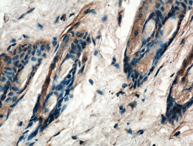 IHC staining of mouse skin using 22686-1-AP