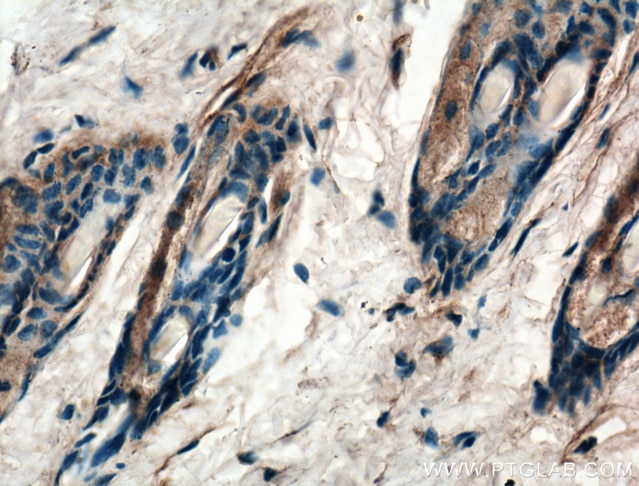 Immunohistochemistry (IHC) staining of mouse skin tissue using TRPV1 Polyclonal antibody (22686-1-AP)