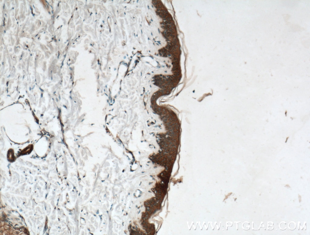 Immunohistochemistry (IHC) staining of human skin tissue using TRPV1 Polyclonal antibody (22686-1-AP)