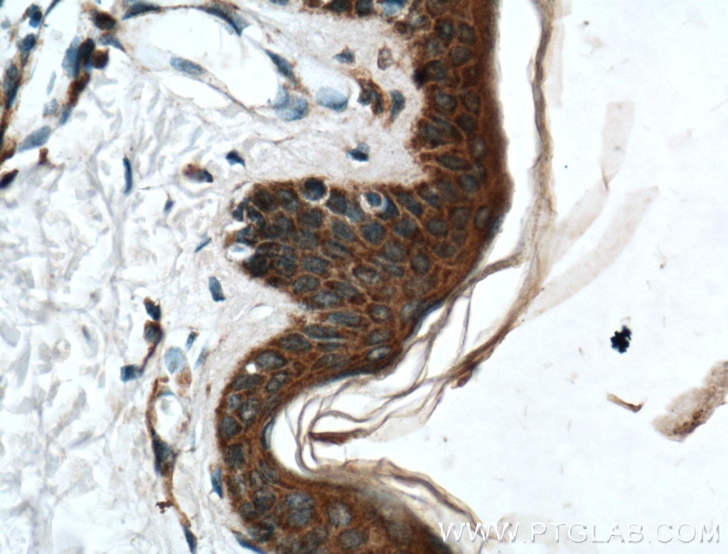 Immunohistochemistry (IHC) staining of human skin tissue using TRPV1 Polyclonal antibody (22686-1-AP)