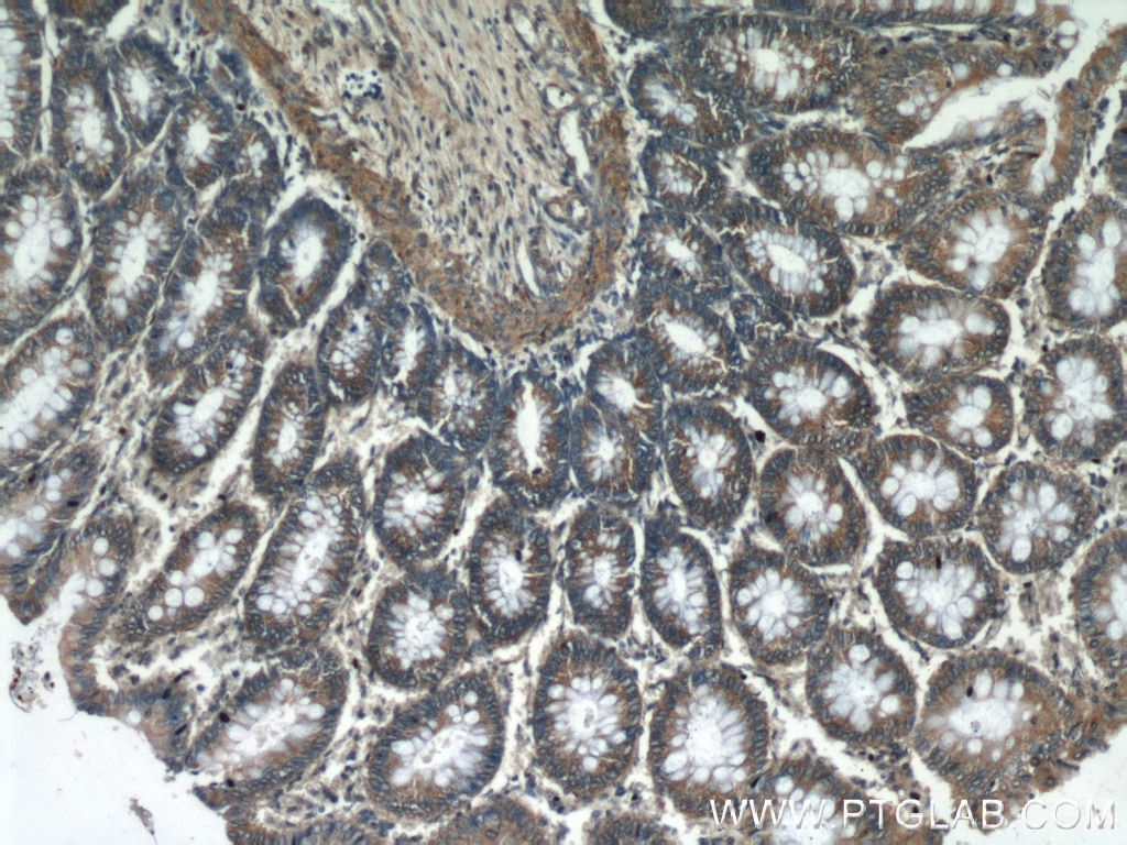 Immunohistochemistry (IHC) staining of human colon tissue using TRPV1 Polyclonal antibody (22686-1-AP)