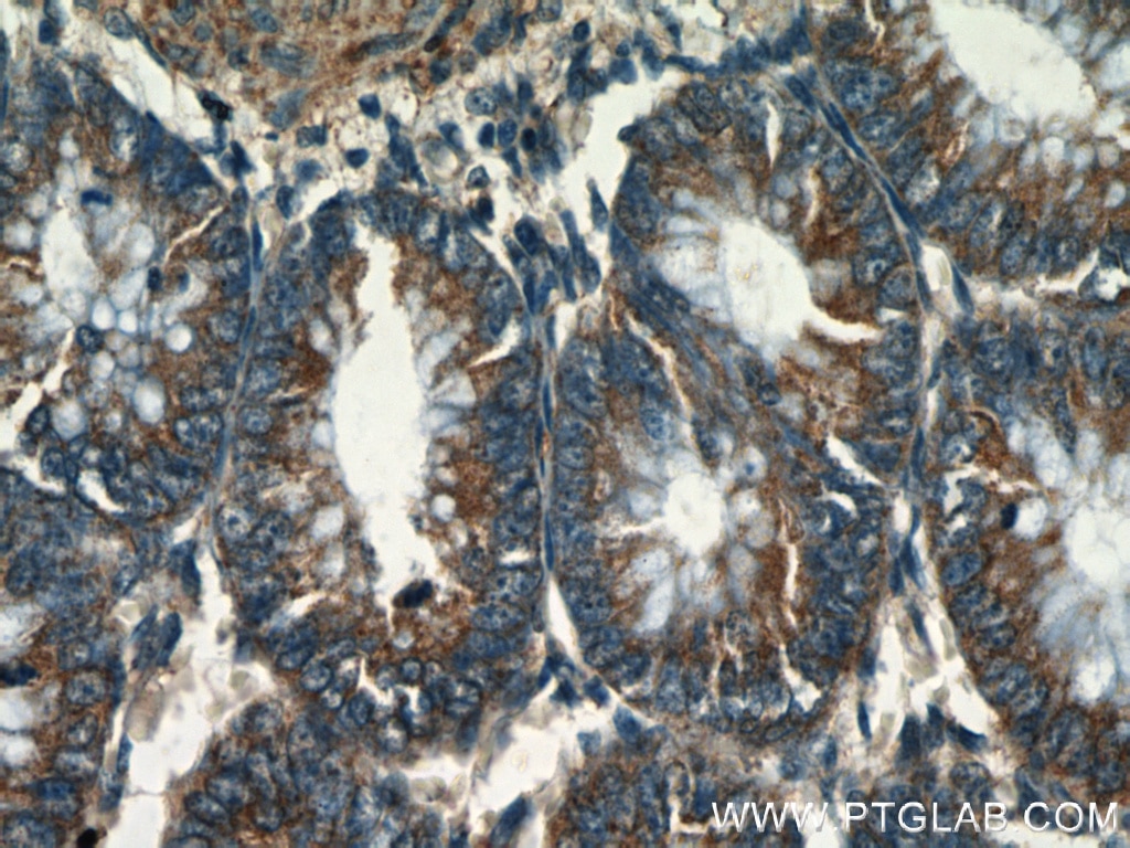 IHC staining of human colon using 22686-1-AP