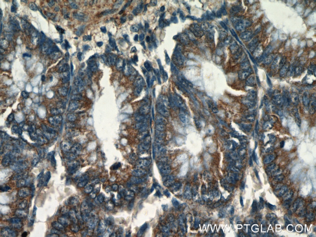 Immunohistochemistry (IHC) staining of human colon tissue using TRPV1 Polyclonal antibody (22686-1-AP)