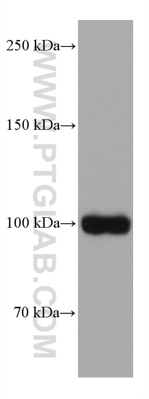 Western Blot (WB) analysis of HepG2 cells using TRPV1 Monoclonal antibody (66983-1-Ig)