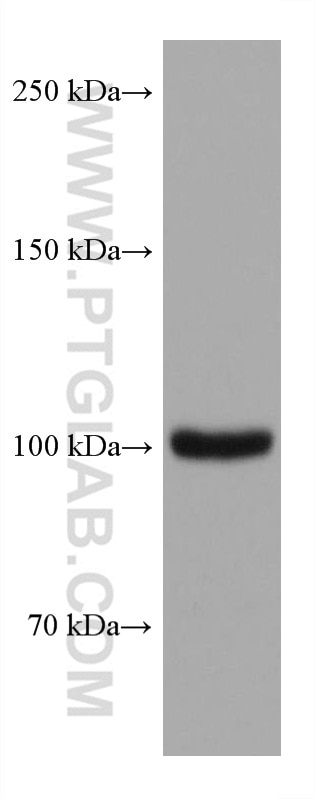 Western Blot (WB) analysis of MDA-MB-468 cells using TRPV1 Monoclonal antibody (66983-1-Ig)