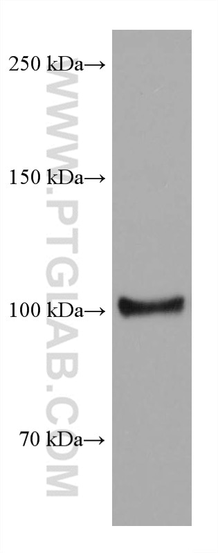 Western Blot (WB) analysis of T-47D cells using TRPV1 Monoclonal antibody (66983-1-Ig)