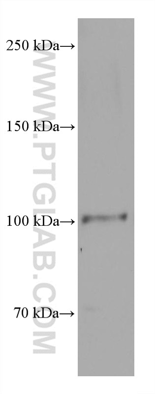 Western Blot (WB) analysis of Y79 cells using TRPV1 Monoclonal antibody (66983-1-Ig)