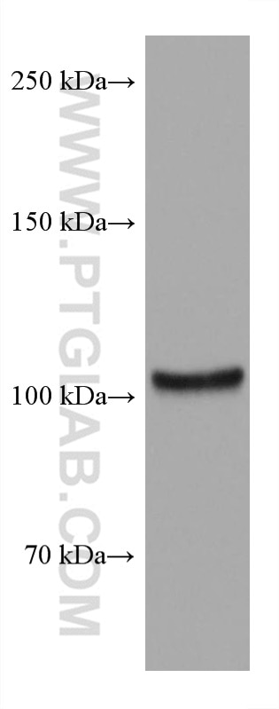 Western Blot (WB) analysis of HUVEC cells using TRPV1 Monoclonal antibody (66983-1-Ig)