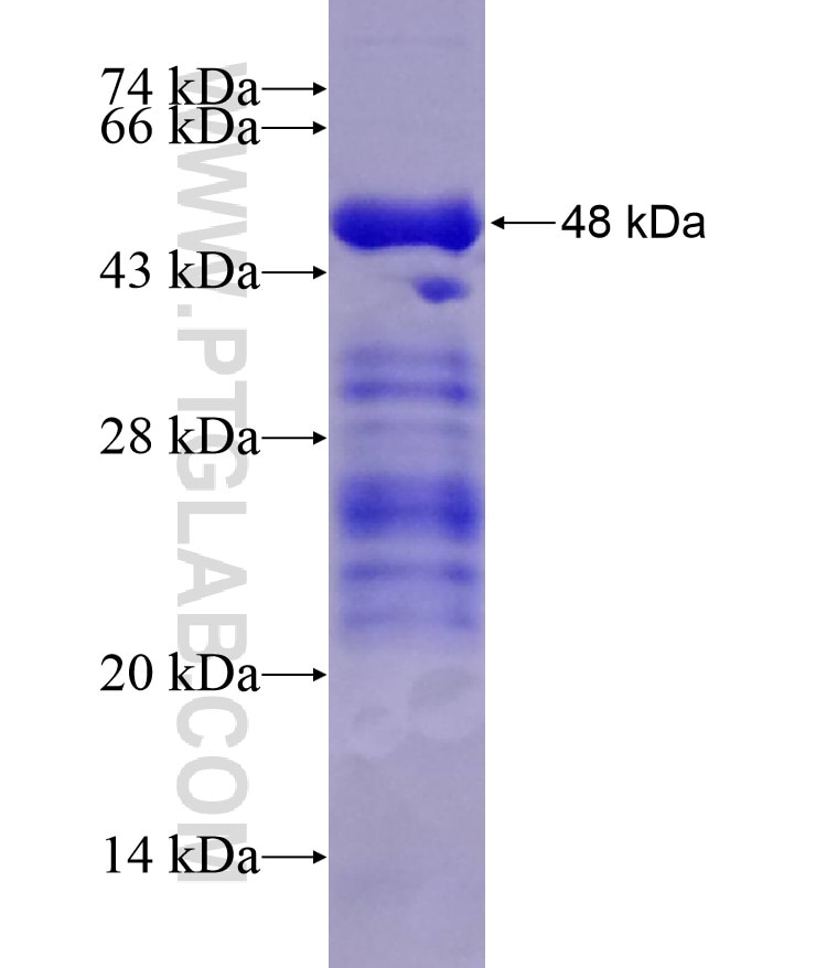 TRPV1 fusion protein Ag18583 SDS-PAGE