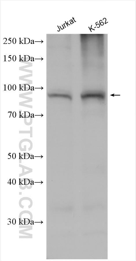 Western Blot (WB) analysis of various lysates using TRPV2 Polyclonal antibody (15991-1-AP)
