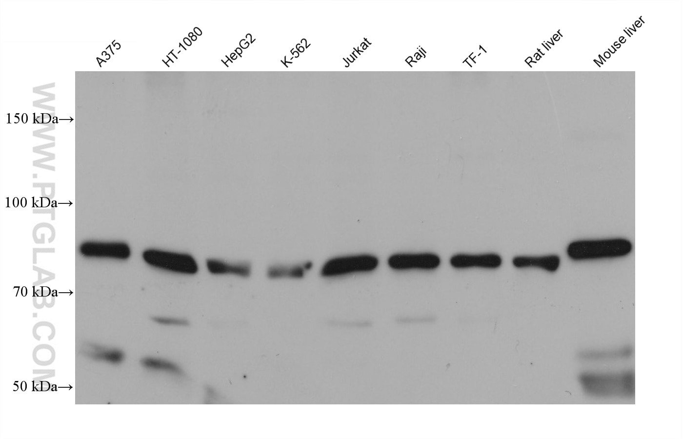 Western Blot (WB) analysis of various lysates using TRPV2 Monoclonal antibody (68563-1-Ig)