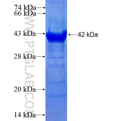 TRPV2 fusion protein Ag8855 SDS-PAGE