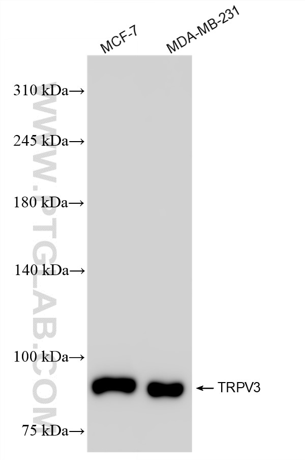 Various lysates were subjected to SDS PAGE followed by western blot with 87098-1-RR (TRPV3 antibody) at dilution of 1:1000 incubated at room temperature for 1.5 hours. This data was developed using the same antibody clone with 87098-1-PBS in a different storage buffer formulation. Western Blot (WB) analysis of various lysates using TRPV3 Recombinant monoclonal antibody (87098-1-RR)