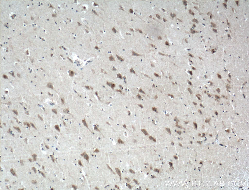Immunohistochemistry (IHC) staining of human brain tissue using TRPV4 Polyclonal antibody (20987-1-AP)