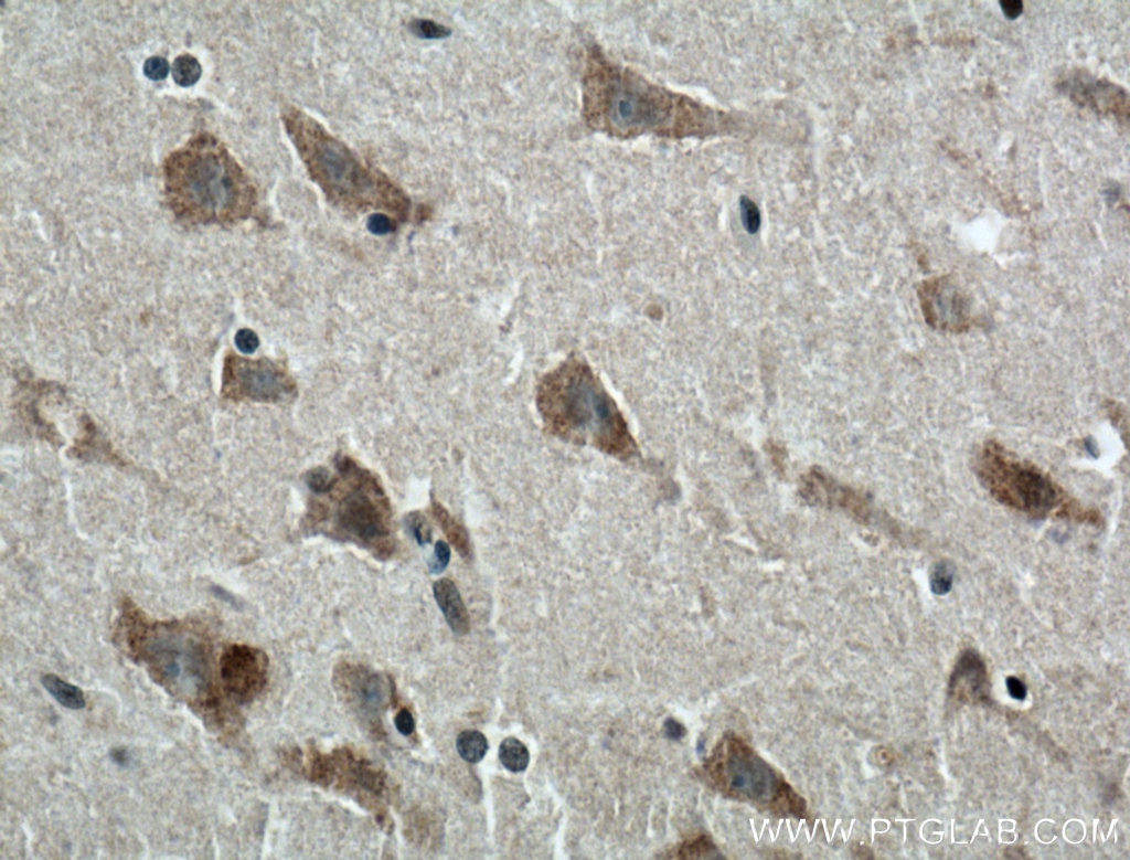 Immunohistochemistry (IHC) staining of human brain tissue using TRPV4 Polyclonal antibody (20987-1-AP)