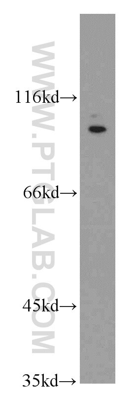 TRPV4 Polyclonal antibody