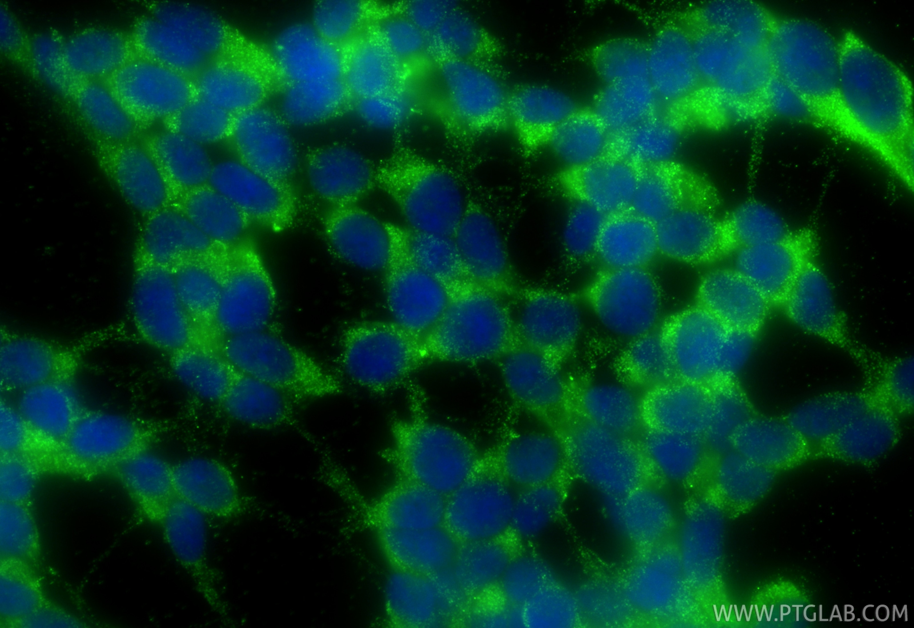 Immunofluorescence (IF) / fluorescent staining of SH-SY5Y cells using TRPV4 Polyclonal antibody (27892-1-AP)