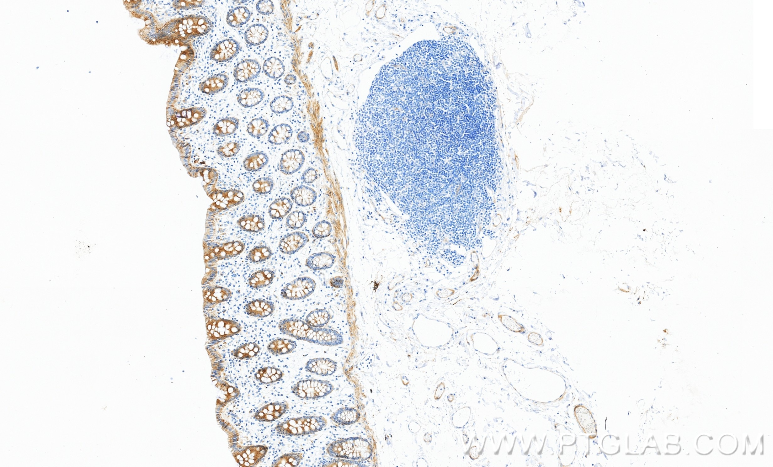 IHC staining of human colon using 98690-1-RR Immunohistochemistry (IHC) staining of human colon tissue using Anti-Human TRPV4 Rabbit Recombinant Antibody (98690-1-RR)