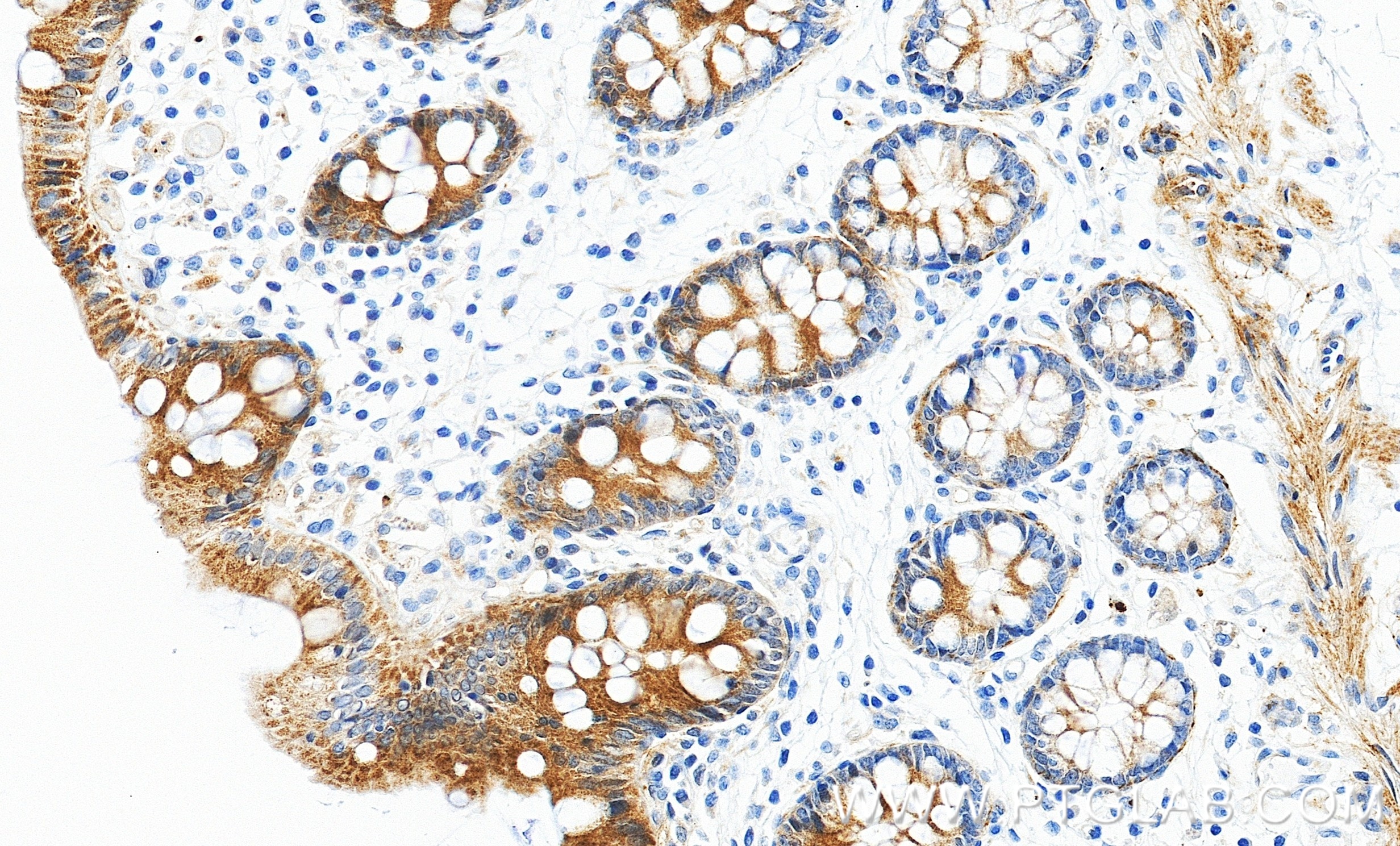 IHC staining of human colon using 98690-1-RR Immunohistochemistry (IHC) staining of human colon tissue using Anti-Human TRPV4 Rabbit Recombinant Antibody (98690-1-RR)