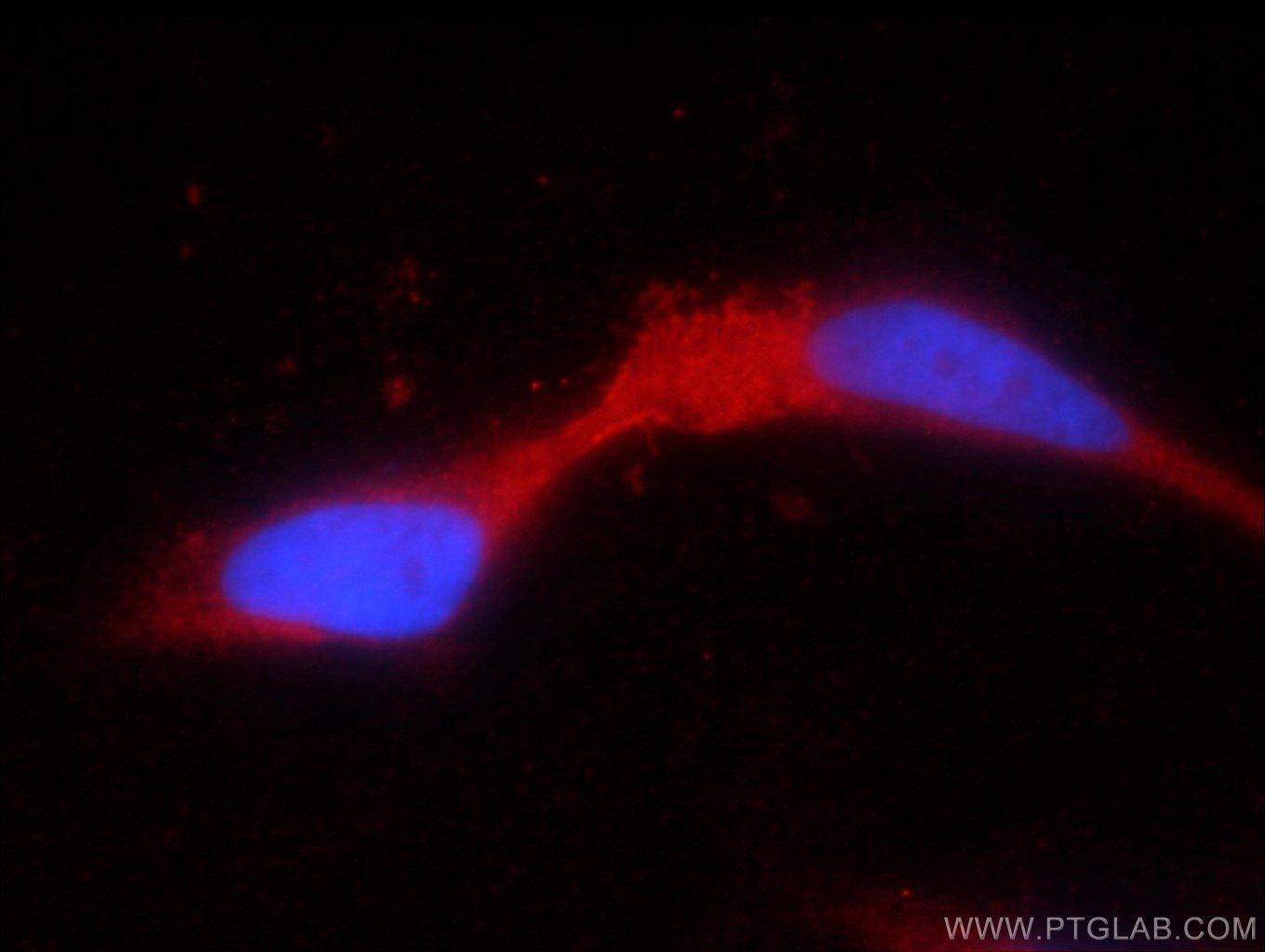 Immunofluorescence (IF) / fluorescent staining of HEK-293 cells using TRPV5 Polyclonal antibody (17322-1-AP)