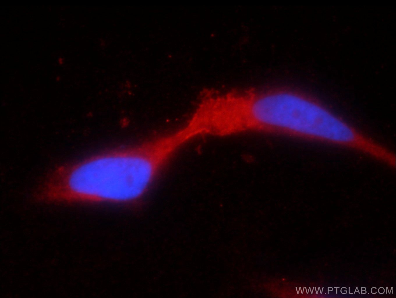 TRPV5 Polyclonal antibody