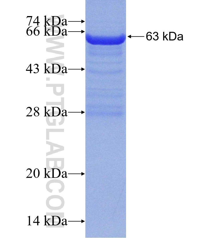 TRPV5 fusion protein Ag11298 SDS-PAGE