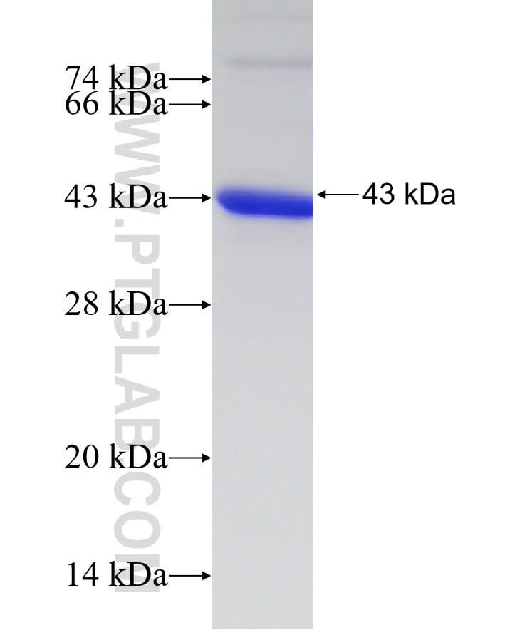 TRPV5 fusion protein Ag11326 SDS-PAGE
