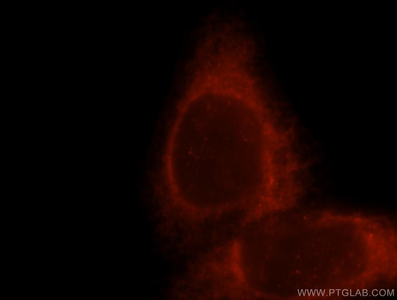 Immunofluorescence (IF) / fluorescent staining of HeLa cells using TRPV6 Polyclonal antibody (13411-1-AP)