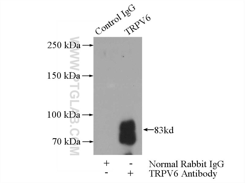 Immunoprecipitation (IP) experiment of mouse kidney tissue using TRPV6 Polyclonal antibody (13411-1-AP)