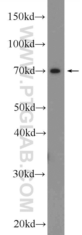 Western Blot (WB) analysis of human placenta tissue using TRPV6 Polyclonal antibody (13411-1-AP)