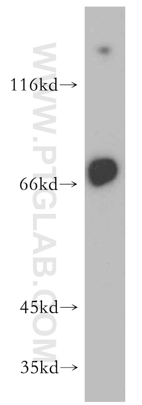 WB analysis of human placenta using 13411-1-AP