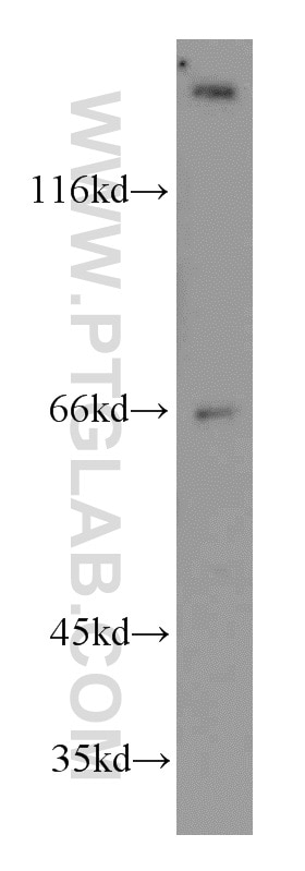 Western Blot (WB) analysis of mouse kidney tissue using TRPV6 Polyclonal antibody (13411-1-AP)