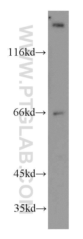 WB analysis of mouse kidney using 13411-1-AP