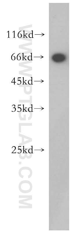 Western Blot (WB) analysis of PC-3 cells using TRPV6 Polyclonal antibody (13411-1-AP)