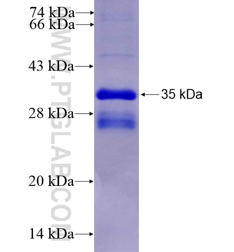 TRPV6 fusion protein Ag4060 SDS-PAGE