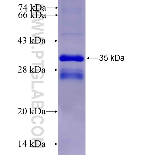 TRPV6 fusion protein Ag4060 SDS-PAGE