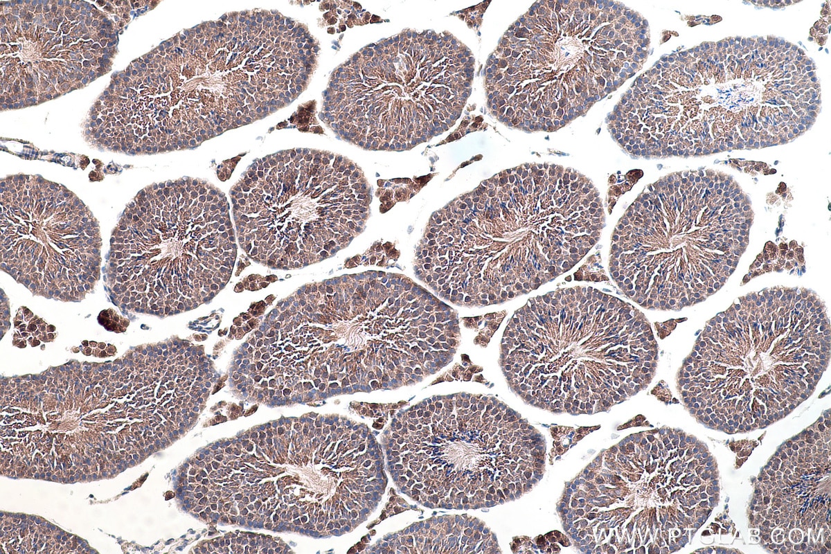 Immunohistochemistry (IHC) staining of mouse testis tissue using TRUB1 Polyclonal antibody (12520-1-AP)
