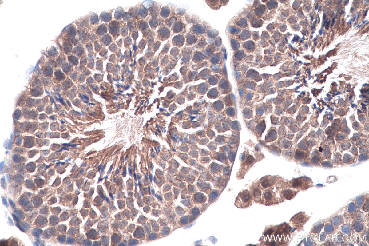 IHC staining of mouse testis using 12520-1-AP