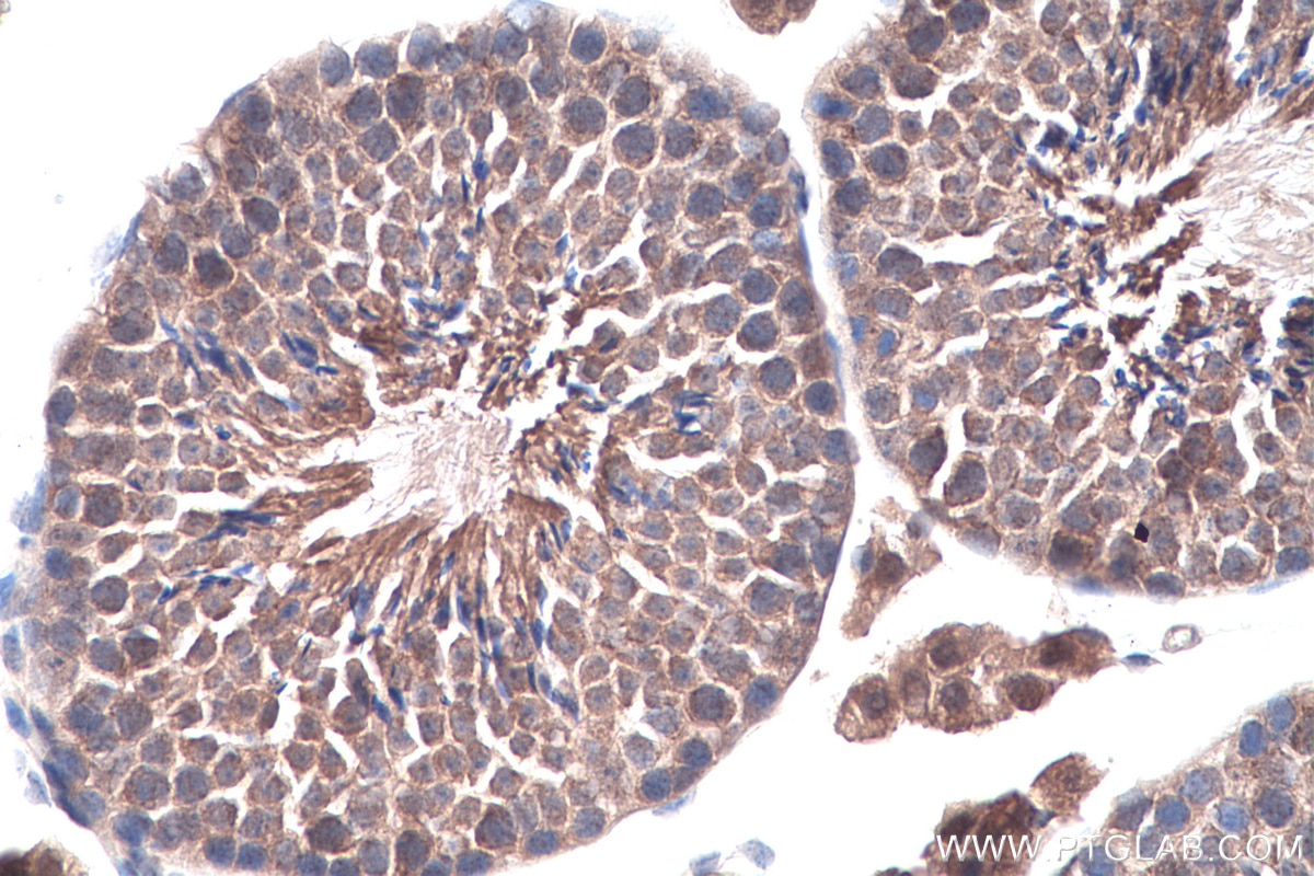 Immunohistochemistry (IHC) staining of mouse testis tissue using TRUB1 Polyclonal antibody (12520-1-AP)