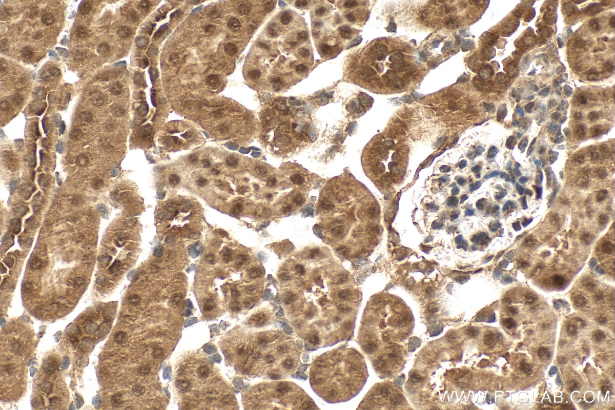 Immunohistochemistry (IHC) staining of mouse kidney tissue using TRUB1 Polyclonal antibody (12520-1-AP)