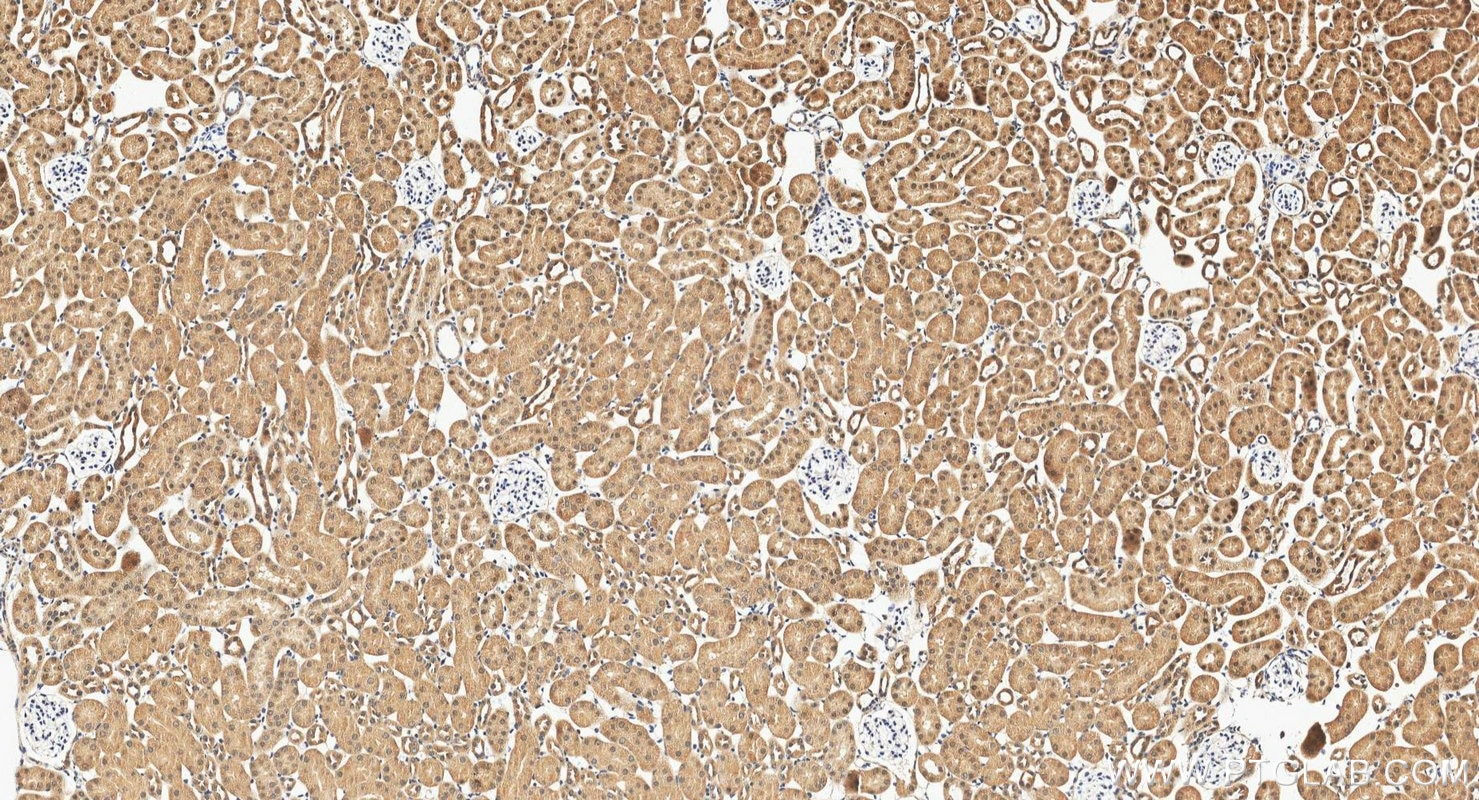 IHC staining of mouse kidney using 12520-1-AP Immunohistochemistry (IHC) staining of mouse kidney tissue using TRUB1 Polyclonal antibody (12520-1-AP)