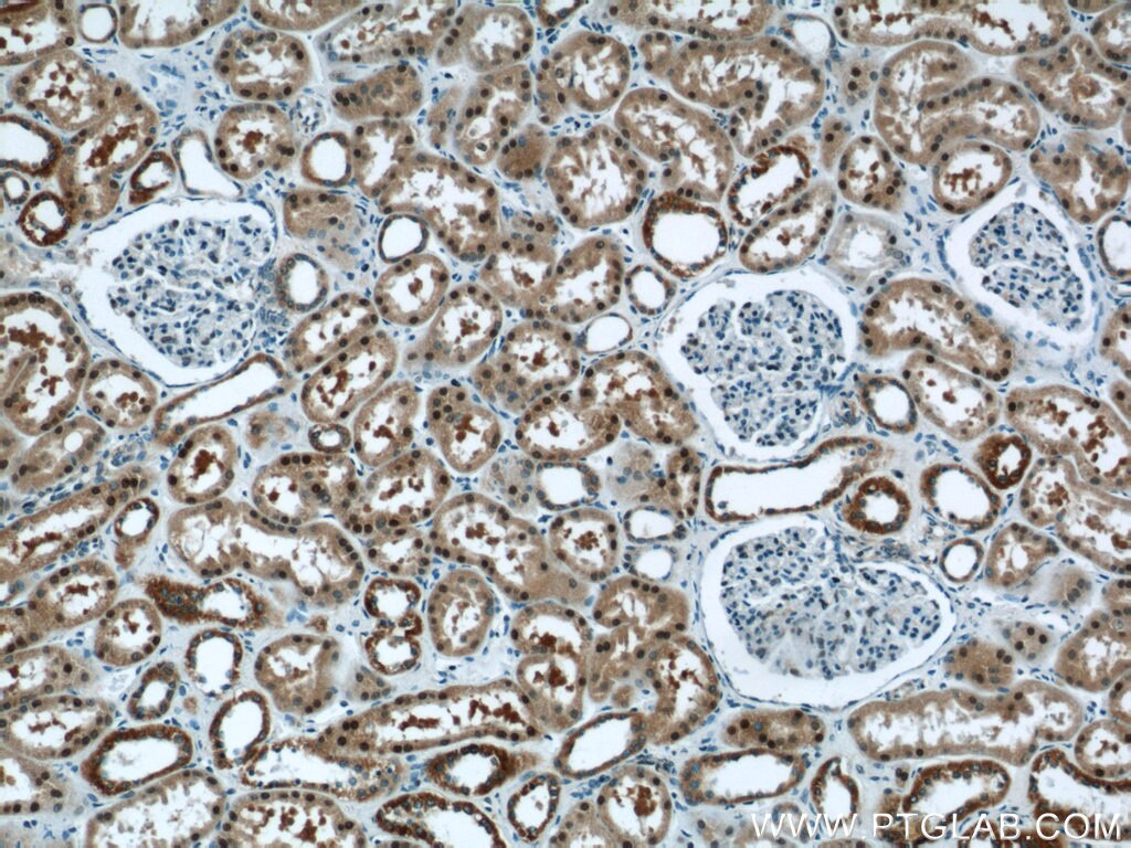 Immunohistochemistry (IHC) staining of human kidney tissue using TRUB1 Polyclonal antibody (12520-1-AP)