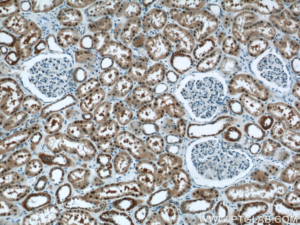 IHC staining of human kidney using 12520-1-AP