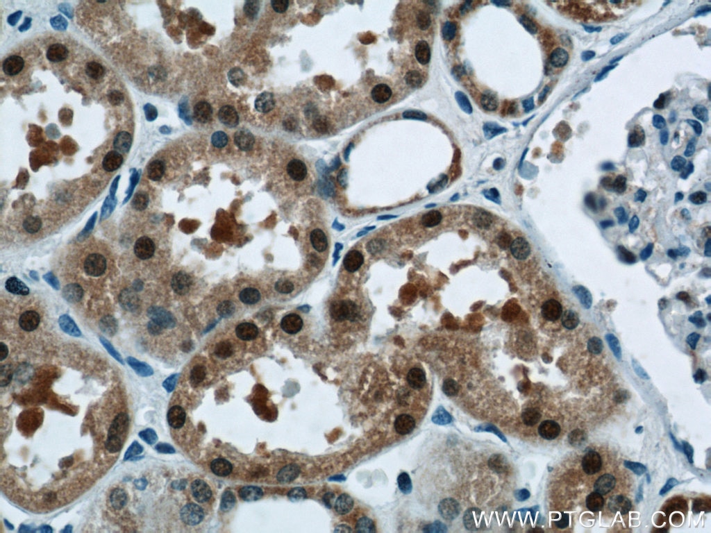 Immunohistochemistry (IHC) staining of human kidney tissue using TRUB1 Polyclonal antibody (12520-1-AP)